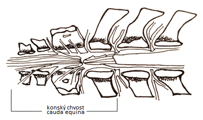 Cauda equina